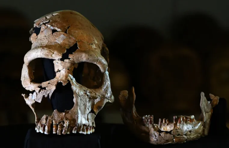 Genes de Neandertais podem explicar distúrbio em que cérebro se projeta para fora do crânio