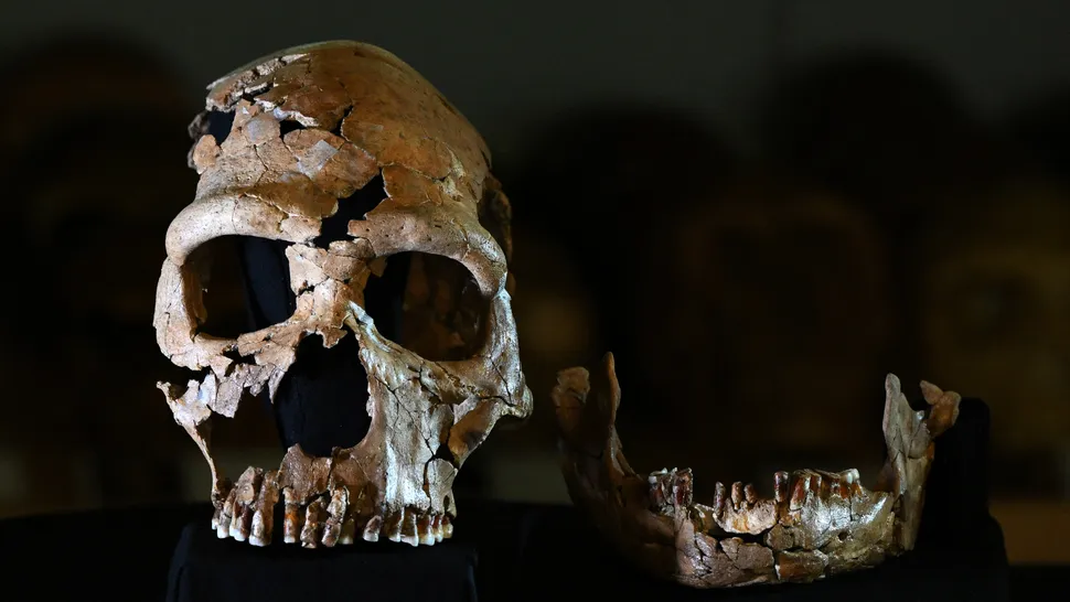 Genes de Neandertais podem explicar distúrbio em que cérebro se projeta para fora do crânio